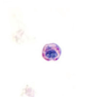 Blastocystis hominis, trichrome stain