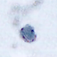 Blastocystis hominis, trichrome stain