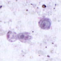 Blastocystis hominis, trichrome stain
