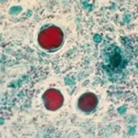 Blastocystis hominis, trichrome stain