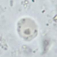 Blastocystis hominis, unstained cyst-like form