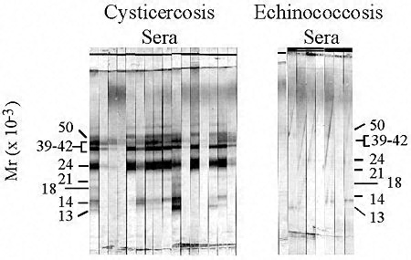 Cysticercosis immunoblot