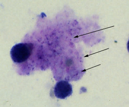 Pneumocystis jiroveci trophozoites