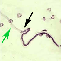 Case 24 Image C