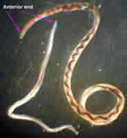 Case 46 Image C