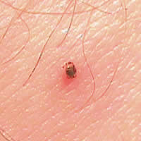 Case 60 Image A