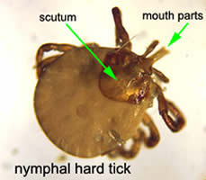 Case 60 Image B