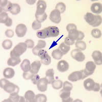 Case 75 Image A