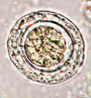 Case 9 Image A