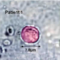 Case 28 Image A