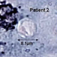 Case 28 Image B