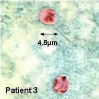 Case 28 Image C