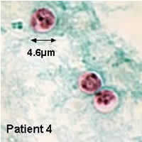 Case 28 Image D