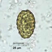 Case 29 Image B