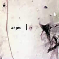 Case 30 Image A
