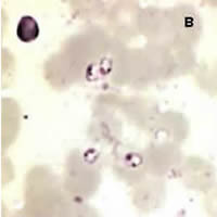 Case 30 Image B