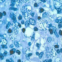 Case 30 Image C