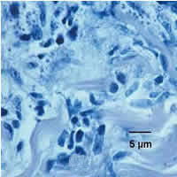 Case 30 Image D