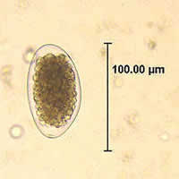 Case 45 Image A