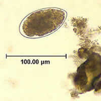 Case 45 Image B
