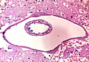Case 46 Image A