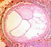 Case 46 Image B