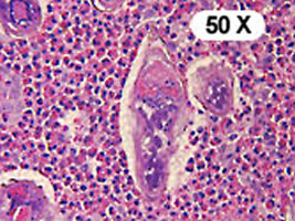 Case 56 Image D