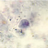 Case 58 Image C