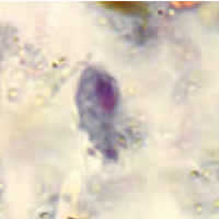 Case 58 Image E