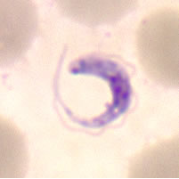 Case 59 Image A