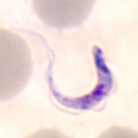 Case 59 Image B
