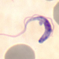 Case 59 Image C