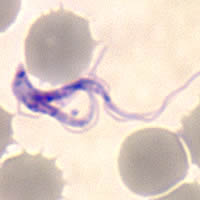 Case 59 Image E