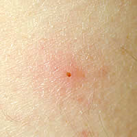 Case 60 Image D