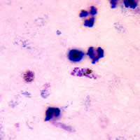 Case 64 Image C