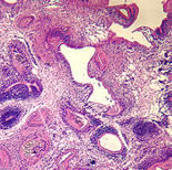   Case 67 Image A