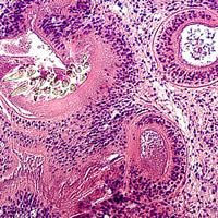 Case 67 Image B