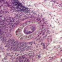 Case 67 Image C