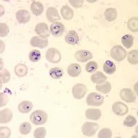 Case 75 Image A