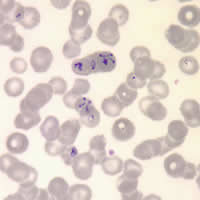 Case 75 Image B