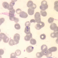 Case 75 Image C