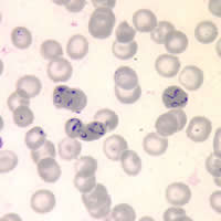 Case 75 Image D