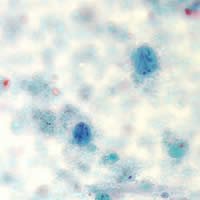 Case 76 Image B