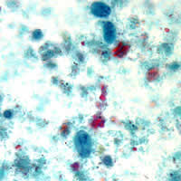 Case 76 Image C