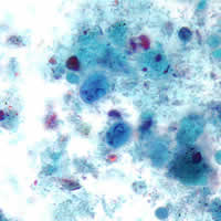 Case 76 Image D