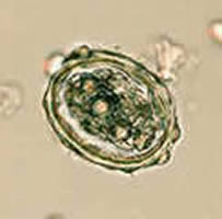 Case 9 Image A
