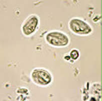 Case 9 Image C
