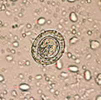 Case 9 Image E