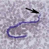 Case 24 Image A