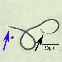 Case 24 Image B